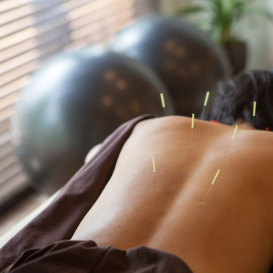 Find Acupuncture near me